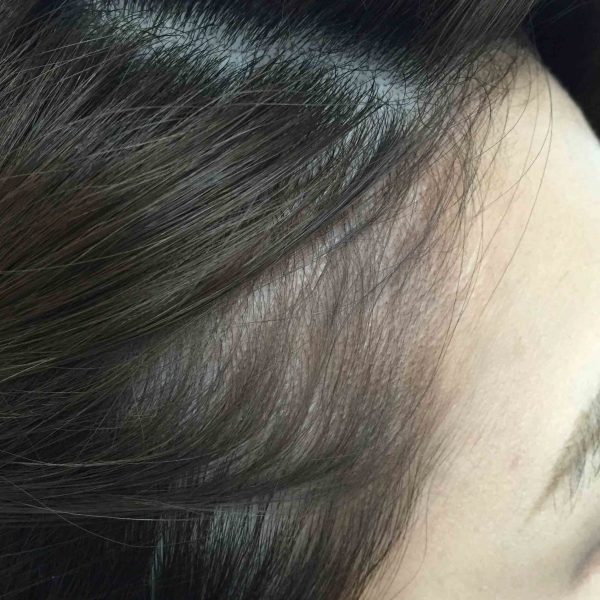 3CEヘアラインシャドウ